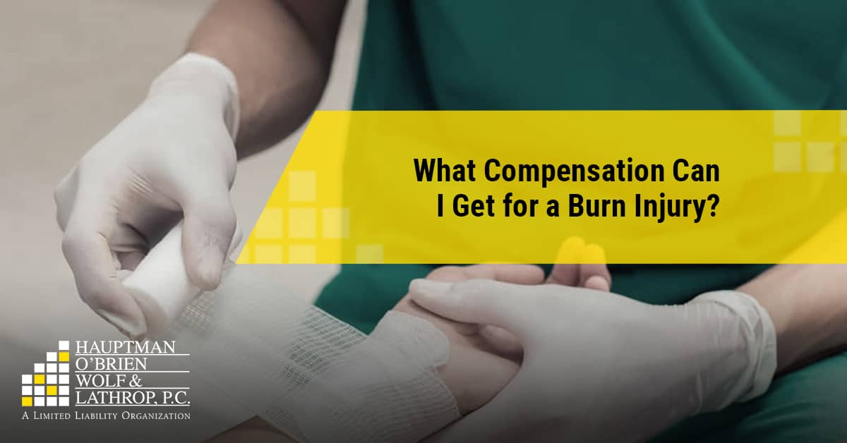 Burn Injury Compensation | Hauptman O'Brien Wolf & Lathrop